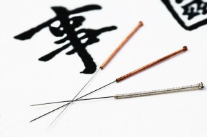 acupuncture needles