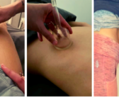 Body Contouring: The Spa Treatment That Lifts, Sculpts & Rejuvenates